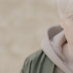 Albinismus je mnohem víc než nedostatek pigmentace, tvrdí genetici