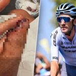 Cyklista Harper přišel v pádu na Tour o kus prstu: Jsem o 10 gramů lehčí, vtipkoval